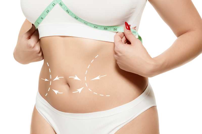 body with drawing arrows liposuction