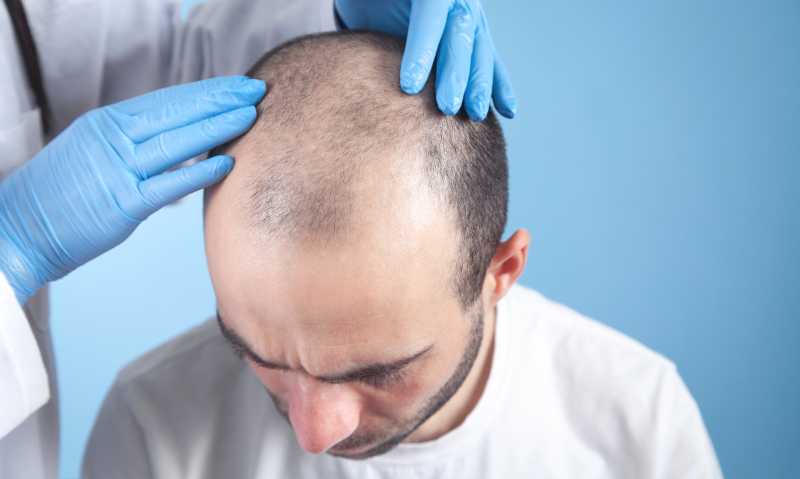 doctor hands on patient head hair growth