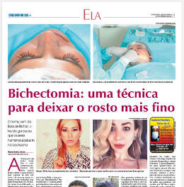 Bichectomia Jornal Cruzeiro do Sul